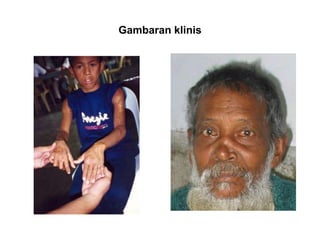 Gambaran klinis
 