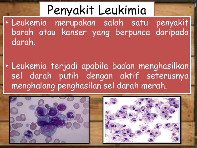 Penyakit leukimia Penyakit leukimia