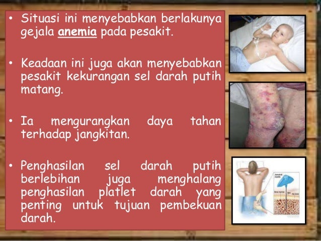 Penyakit leukimia Penyakit leukimia