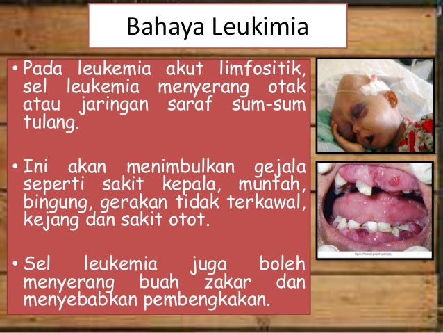 Penyakit leukimia Penyakit leukimia