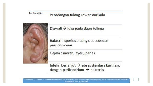 PENYAKIT LIANG TELINGA INFLAMASI DAUN TELINGA pptx PENYAKIT LIANG TELINGA INFLAMASI DAUN TELINGA pptx