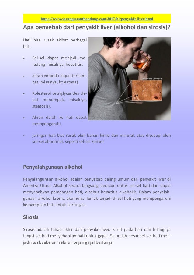 Penyakit Liver