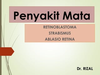 Penyakit Mata
RETINOBLASTOMA
STRABISMUS
ABLASIO RETINA
Dr. RIZAL
 