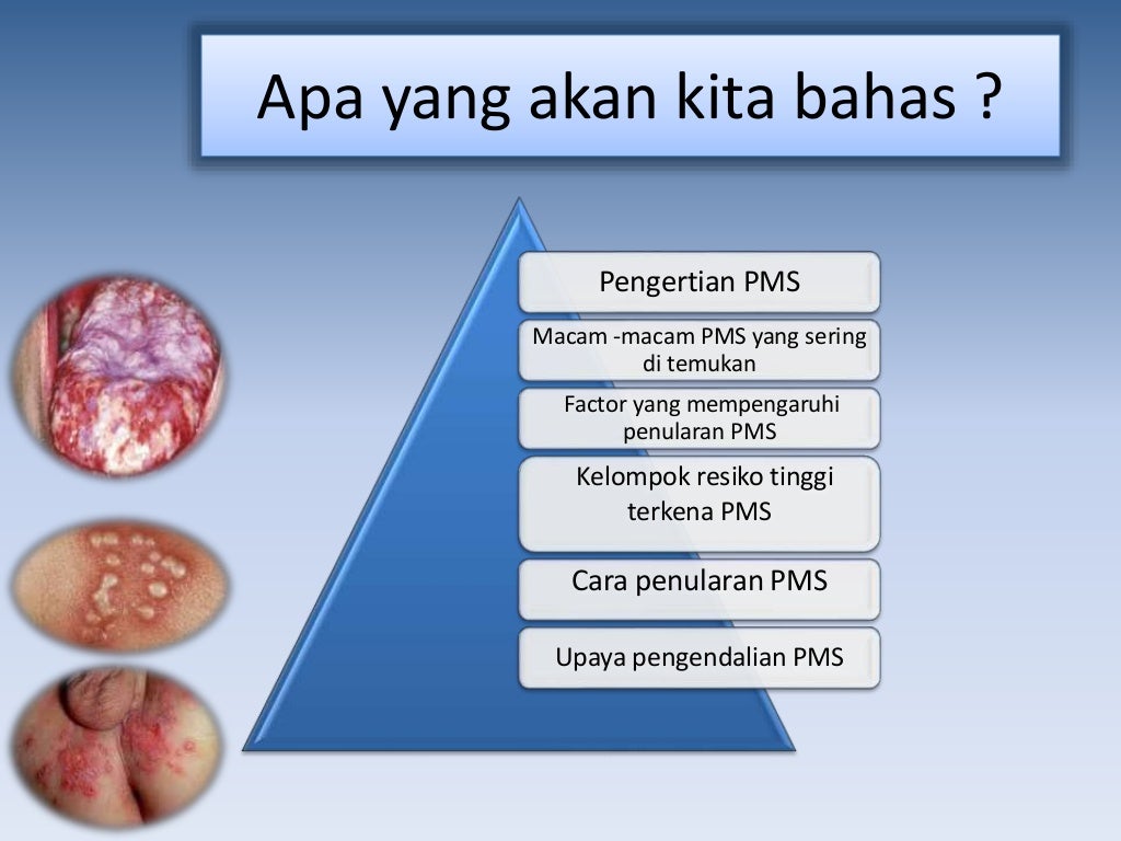 Penyakit menular seksual