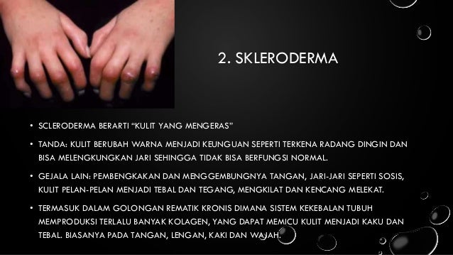 Penyakit Pada Ekstremitas Atas Dan Ekstremitas Bawah penyakit pada ekstremitas atas dan ekstremitas bawah