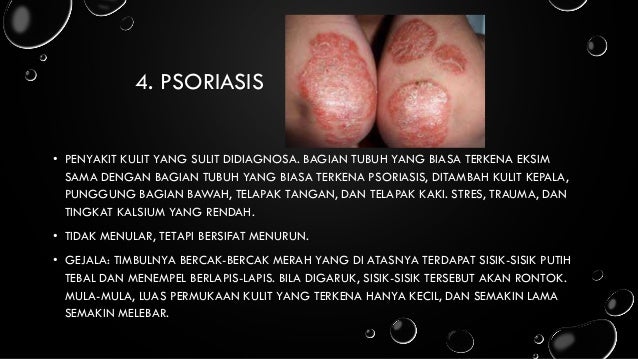 Penyakit pada ekstremitas atas dan ekstremitas bawah
