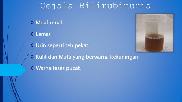  Penyakit  pada ginjal Albuminuria  Anuria Glikosaria dan sbg 