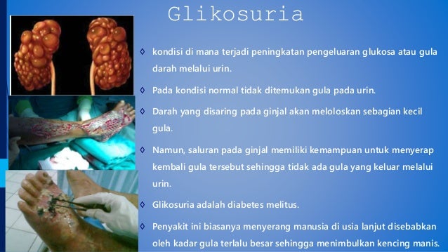  Penyakit  pada ginjal Albuminuria  Anuria Glikosaria dan sbg 