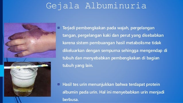 Gambar Penyakit Riketsia : Konsep Timbulnya Penyakit - FansBuku