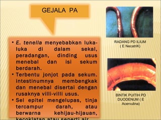 • E. tenella menyebabkan luka-
luka di dalam sekal,
peradangan, dinding usus
menebal dan isi sekum
berdarah.
• Terbentu jonjot pada sekum.
intestinumnya membengkak
dan menebal disertai dengan
rusaknya villi-villi usus.
• Sel epitel mengelupas, tinja
tercampur darah, atau
berwarna kehijau-hijauan,
GEJALA PA
RADANG PD ILIUM
( E NecatriK)
BINTIK PUITIH PD
DUODENUM ( E
Acervulina)
 