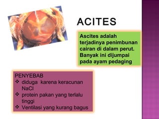 ACITES
Ascites adalah
terjadinya penimbunan
cairan di dalam perut.
Banyak ini dijumpai
pada ayam pedaging
PENYEBAB
 diduga karena keracunan
NaCl
 protein pakan yang terlalu
tinggi
 Ventilasi yang kurang bagus
 