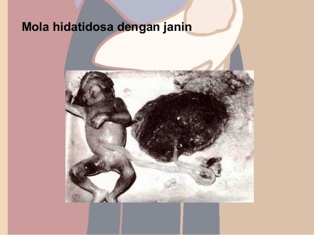 Penyakit serta kelainan plasenta