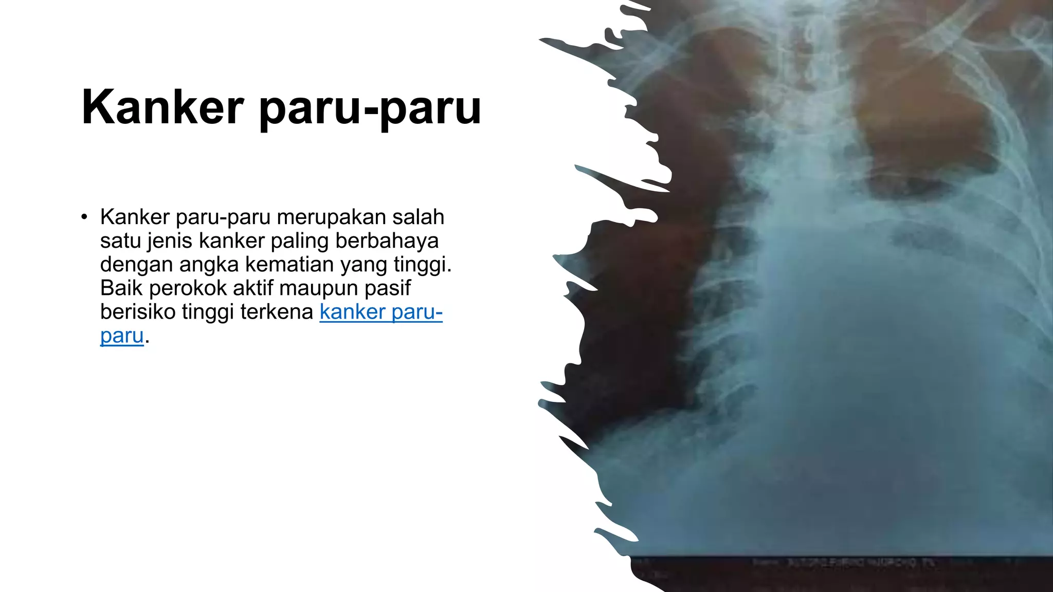 PENYAKIT SISTEM RESPIRASI.pptx