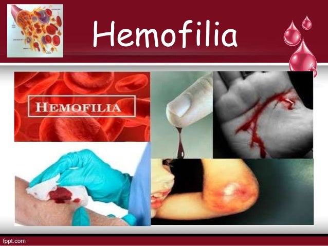 Diet Untuk Penderita Hemofilia Espanol