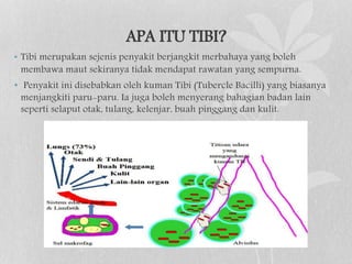 Penyakit tibi | PPT