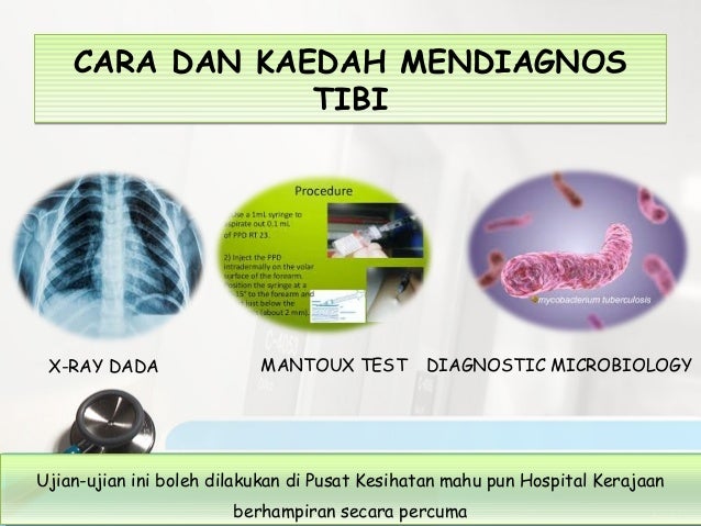 Penyakit tuberkulosis @ tibi dani