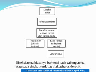 Diseksi
aorta
Robekan intima
koneksi antara
lapisan media
dan lumen aorta
True lumen
(dilapisi
intima)
False lumen
(dilapisan
media)
Aneurisma
Diseksi aorta biasanya berhenti pada cabang aorta
atau pada tingkat terdapat plak atherosklerotik.
Harrison’s principles of Internal Medicine .17ed. USA
 