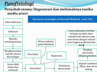 Patofisiologi
Penyebab utama: Degenerasi dan melemahnya tunika
media arteri
Atherosklerosis
deposit trombosit
fibrin, dan sel-sel
radang
Matriks
metaloproteinas
e
Menghancurkan
matriks elastin
dan kolagen
Aorta tidak
elastis dan
melemah
Aneurisma
Turbulensi
aliran darah
Inflamasi
Dinding
aneurisma
dilapisi trombus
Lama kelamaan trombus
berlapis tersebut akan
membentuk saluran yang
sama besar dengan saluran
aorta bagian proksimal dan
distal
Usia lanjut
Aliran turbulen
pada bifurkatio
Hipertensi
Harrison’s principles of Internal Medicine .17ed. USA
 