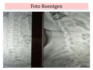 Foto Roentgen
 