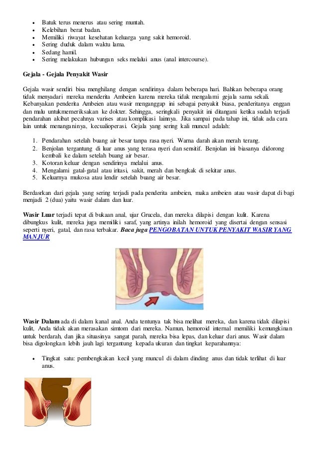 Penyakit wasir dapat diobati tanpa operasi