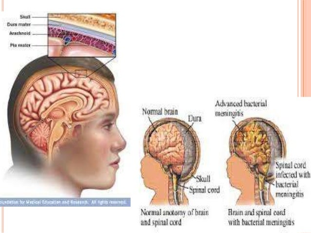 Penyakit Yang Disebabkan Oleh Bakteri Yang Merugikan Penyakit Yang Disebabkan Oleh Bakteri Yang Merugikan