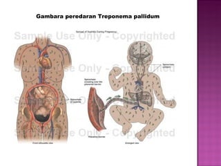 Gambara peredaran T reponema pallidum   