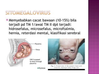 Memyebabkan cacat bawaan (10-15%) bila terjadi pd TM 1/awal TM II dpt terjadi: hidrosefalus, microsefalus, microftalmia, hernia, reterdasi mental, klasifikasi serebral  