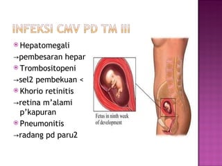 Hepatomegali -> pembesaran hepar Trombositopeni  -> sel2 pembekuan < Khorio retinitis  -> retina m’alami p’kapuran Pneumonitis -> radang pd paru2 