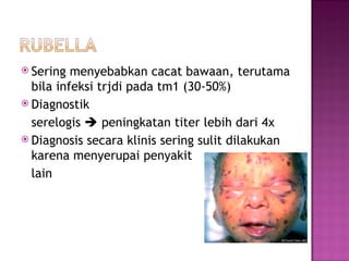 Sering menyebabkan cacat bawaan, terutama bila infeksi trjdi pada tm1 (30-50%) Diagnostik serelogis    peningkatan titer lebih dari 4x Diagnosis secara klinis sering sulit dilakukan karena menyerupai penyakit lain 