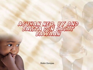 Asuhan neo, by and
balita dgn cacat
bawaan

Robin Dompas

 