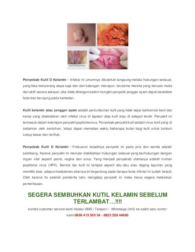  Penyebab kutil  d kelamin