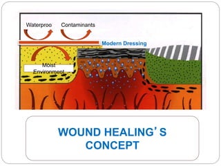 Moist
Environment
Waterproof Contaminants
WOUND HEALING’S
CONCEPT
Moist
Environment
Waterproo
f
Contaminants
Modern Dressing
 
