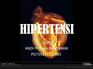 HIPERTENSI
Oleh
ANDI FITRIAH RAMDHANI
PO714201151003
 