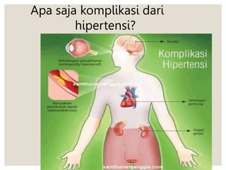 Apa saja komplikasi dari
hipertensi?
 