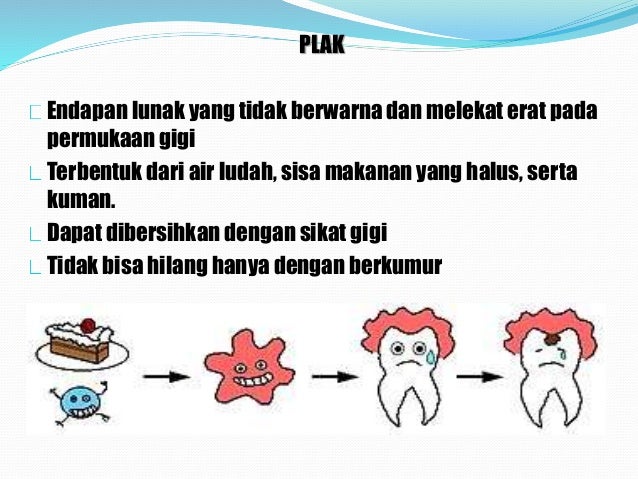 30 Contoh Poster Kesehatan Gigi Dan Mulut Terbaik Kumpulan Gambar Poster