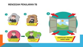 MENCEGAH PENULARAN TB
 