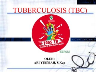 TUBERCULOSIS (TBC)
OLEH:
ARI YUSNIAH, S.Kep
 
