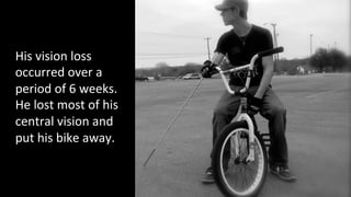 His 
vision 
loss 
occurred 
over 
a 
period 
of 
6 
weeks. 
He 
lost 
most 
of 
his 
central 
vision 
and 
put 
his 
bike 
away. 
 