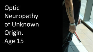 Op4c 
Neuropathy 
of 
Unknown 
Origin. 
Age 
15 
 