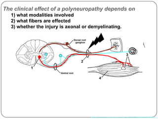 The clinical effect of a polyneuropathy depends on
1) what modalities involved
2) what fibers are effected
3) whether the injury is axonal or demyelinating.
Adapted from http://www.neuroanatomy.wisc.edu/SClinic/Weakness/Weakness.htm
 