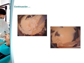 Continuación … 