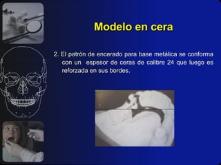 Modelo en cera 2. El patrón de encerado para base metálica se conforma con un  espesor de ceras de calibre 24 que luego es reforzada en sus bordes. 