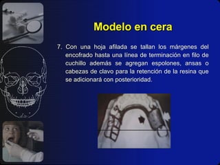 Modelo en cera 7. Con una hoja afilada se tallan los márgenes del encofrado hasta una línea de terminación en filo de cuchillo además se agregan espolones, ansas o cabezas de clavo para la retención de la resina que se adicionará con posterioridad. 