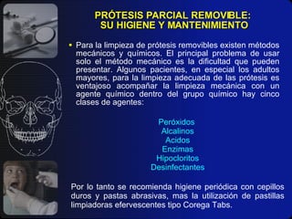 PRÓTESIS PARCIAL REMOVIBLE:  SU HIGIENE Y MANTENIMIENTO Para la limpieza de prótesis removibles existen métodos mecánicos y químicos. El principal problema de usar solo el método mecánico es la dificultad que pueden presentar. Algunos pacientes, en especial los adultos mayores, para la limpieza adecuada de las prótesis es ventajoso acompañar la limpieza mecánica con un agente químico dentro del grupo químico hay cinco clases de agentes: Peróxidos  Alcalinos Acidos Enzimas Hipocloritos Desinfectantes Por lo tanto se recomienda higiene periódica con cepillos duros y pastas abrasivas, mas la utilización de pastillas limpiadoras efervescentes tipo Corega Tabs. 