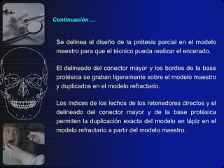 Continuación … Se delinea el diseño de la prótesis parcial en el modelo maestro para que el técnico pueda realizar el encerado. El delineado del conector mayor y los bordes de la base protésica se graban ligeramente sobre el modelo maestro y duplicados en el modelo refractario. Los índices de los lechos de los retenedores directos y el delineado del conector mayor y de la base protésica permiten la duplicación exacta del modelo en lápiz en el modelo refractario a partir del modelo maestro. 