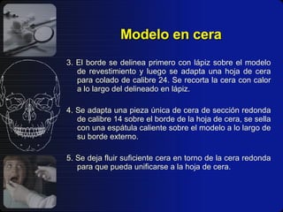 Modelo en cera 3. El borde se delinea primero con lápiz sobre el modelo de revestimiento y luego se adapta una hoja de cera para colado de calibre 24. Se recorta la cera con calor a lo largo del delineado en lápiz. 4. Se adapta una pieza única de cera de sección redonda de calibre 14 sobre el borde de la hoja de cera, se sella con una espátula caliente sobre el modelo a lo largo de su borde externo. 5. Se deja fluir suficiente cera en torno de la cera redonda para que pueda unificarse a la hoja de cera. 