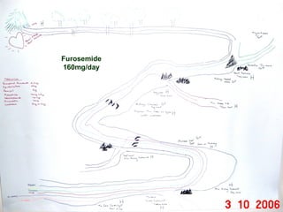 Furosemide 160mg/day 