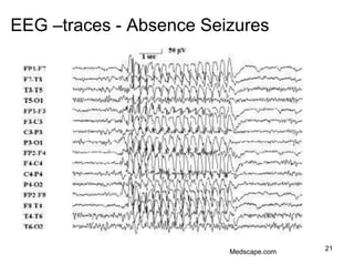 21
EEG –traces - Absence Seizures
Adapted from Rang et al., 2005
Medscape.com
 