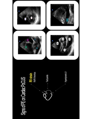 pe pocus pdf.pdf Pocus Pocus Pocus pocus | PDF