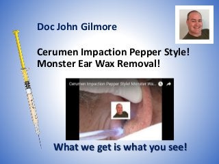Cerumen Impaction Pepper Style!
Monster Ear Wax Removal!
What we get is what you see!
Doc John Gilmore
 